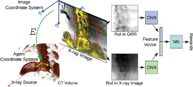 Figure 3 for Dilated FCN for Multi-Agent 2D/3D Medical Image Registration