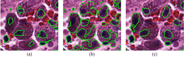 Figure 3 for Micro-Net: A unified model for segmentation of various objects in microscopy images