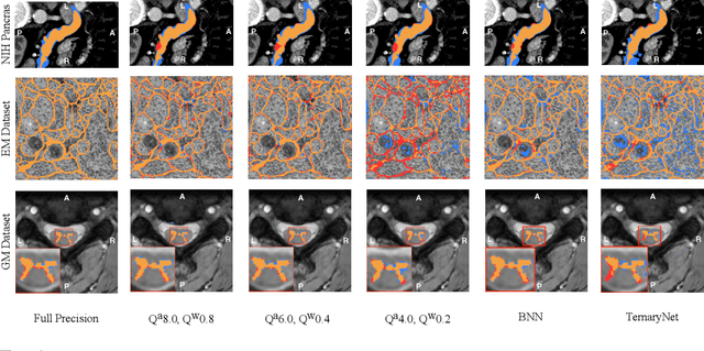 Figure 1 for U-Net Fixed-Point Quantization for Medical Image Segmentation