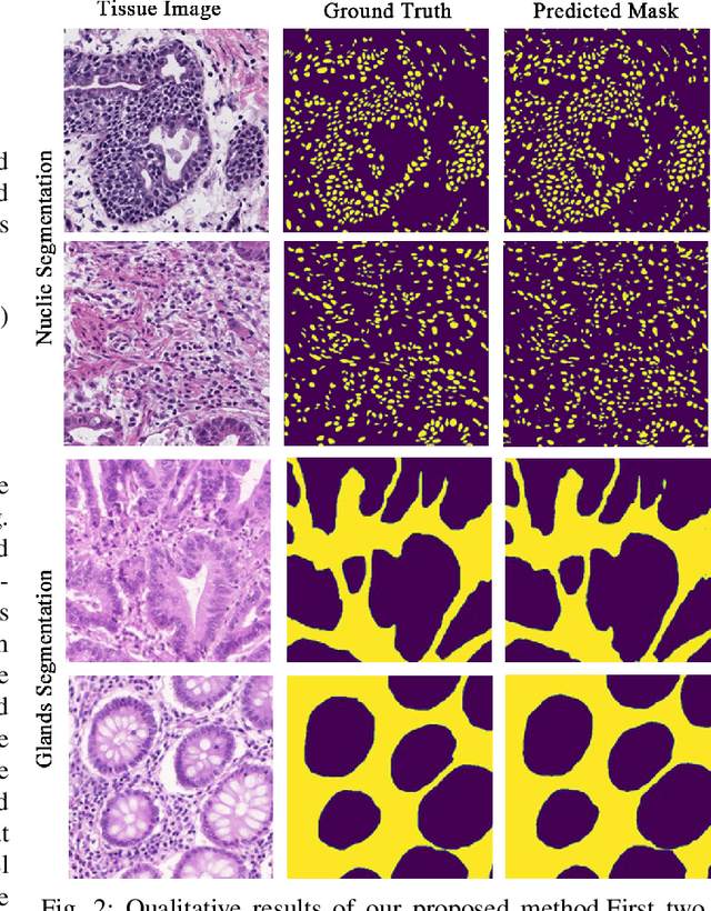 Figure 2 for HistoSeg : Quick attention with multi-loss function for multi-structure segmentation in digital histology images