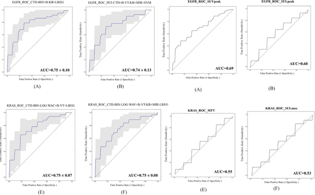 Figure 3 for PET/CT Radiomic Sequencer for Prediction of EGFR and KRAS Mutation Status in NSCLC Patients