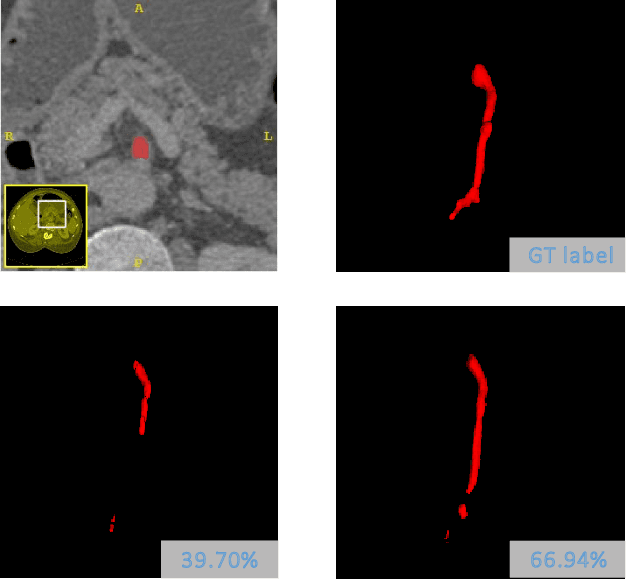 Figure 1 for Thickened 2D Networks for 3D Medical Image Segmentation
