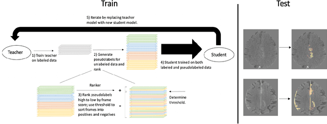 Figure 1 for Noisy Student learning for cross-institution brain hemorrhage detection