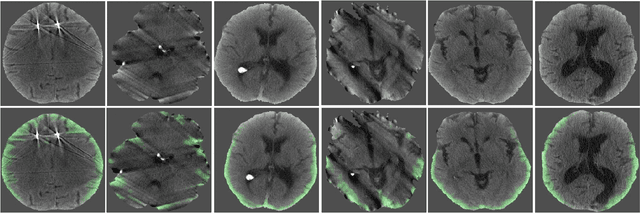 Figure 3 for Noisy Student learning for cross-institution brain hemorrhage detection