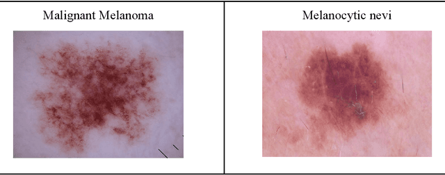 Figure 1 for Comparison of Deep Learning and Machine Learning Models and Frameworks for Skin Lesion Classification
