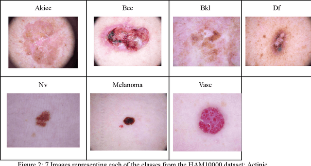 Figure 2 for Comparison of Deep Learning and Machine Learning Models and Frameworks for Skin Lesion Classification