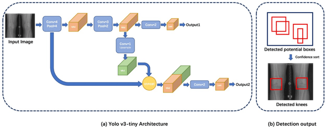 Figure 4 for Automated Grading of Radiographic Knee Osteoarthritis Severity Combined with Joint Space Narrowing