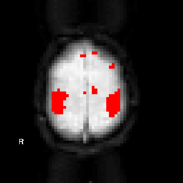 Figure 1 for A Framework for Exploring Non-Linear Functional Connectivity and Causality in the Human Brain: Mutual Connectivity Analysis (MCA) of Resting-State Functional MRI with Convergent Cross-Mapping and Non-Metric Clustering