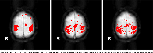 Figure 4 for A Framework for Exploring Non-Linear Functional Connectivity and Causality in the Human Brain: Mutual Connectivity Analysis (MCA) of Resting-State Functional MRI with Convergent Cross-Mapping and Non-Metric Clustering