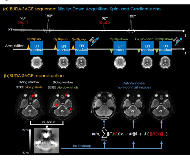 Figure 1 for BUDA-SAGE with self-supervised denoising enables fast, distortion-free, high-resolution T2, T2*, para- and dia-magnetic susceptibility mapping