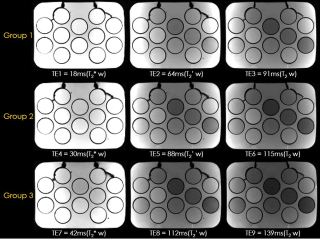 Figure 3 for BUDA-SAGE with self-supervised denoising enables fast, distortion-free, high-resolution T2, T2*, para- and dia-magnetic susceptibility mapping