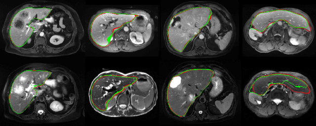 Figure 4 for Comparing Deep Learning strategies for paired but unregistered multimodal segmentation of the liver in T1 and T2-weighted MRI