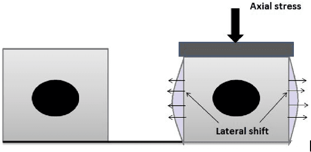 Figure 1 for Imrpoving Strain Estimation in Breast Ultrasound Images Using Novel 1.5D Approach (Simulation and In-vivo results