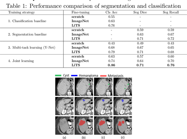 Figure 2 for Joint Liver Lesion Segmentation and Classification via Transfer Learning