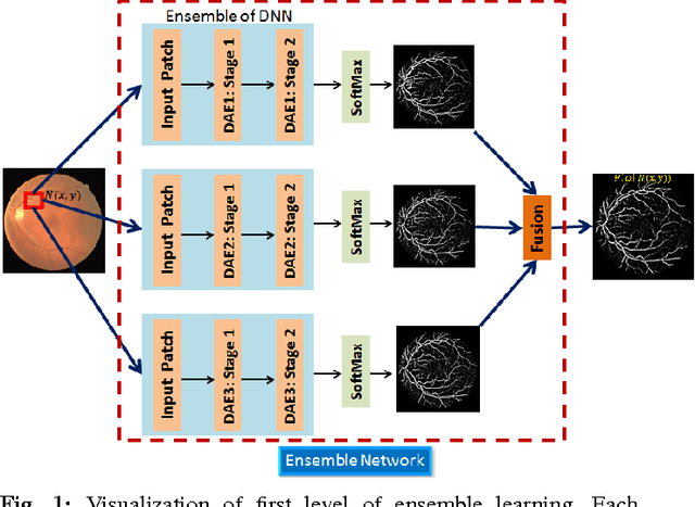 Figure 1 for Deep Neural Ensemble for Retinal Vessel Segmentation in Fundus Images towards Achieving Label-free Angiography