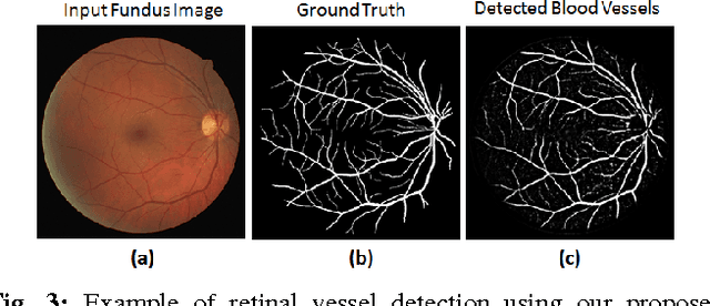 Figure 3 for Deep Neural Ensemble for Retinal Vessel Segmentation in Fundus Images towards Achieving Label-free Angiography