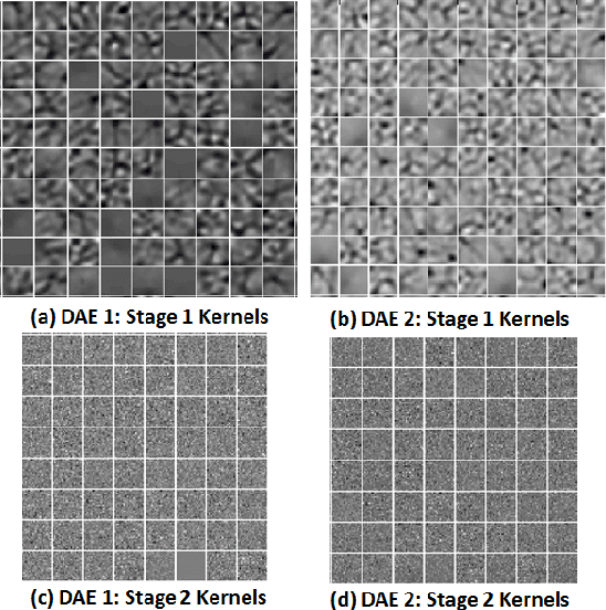 Figure 4 for Deep Neural Ensemble for Retinal Vessel Segmentation in Fundus Images towards Achieving Label-free Angiography