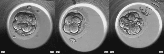 Figure 1 for Embryo staging with weakly-supervised region selection and dynamically-decoded predictions