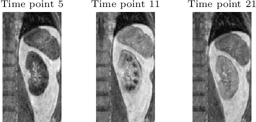 Figure 4 for Variational Registration of Multiple Images with the SVD based SqN Distance Measure