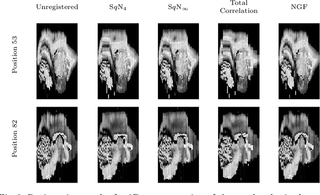 Figure 2 for Variational Registration of Multiple Images with the SVD based SqN Distance Measure