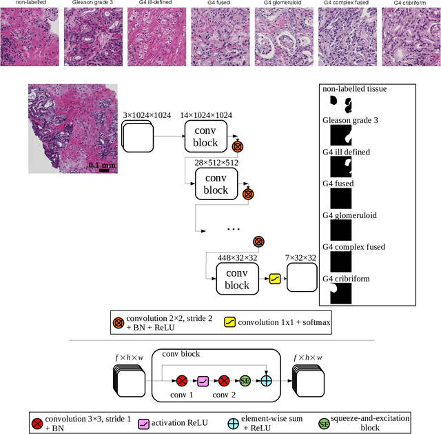 Figure 2 for Automated Detection of Cribriform Growth Patterns in Prostate Histology Images