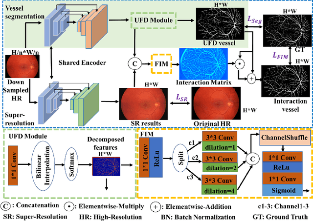 Figure 1 for SuperVessel: Segmenting High-resolution Vessel from Low-resolution Retinal Image