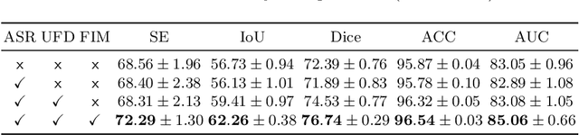 Figure 2 for SuperVessel: Segmenting High-resolution Vessel from Low-resolution Retinal Image