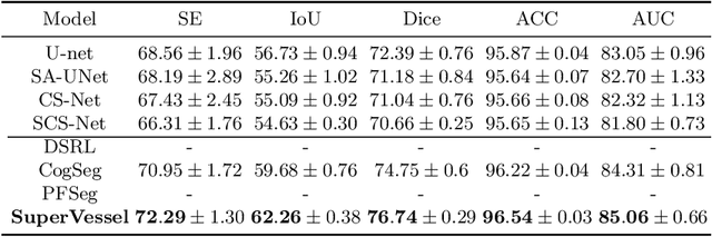 Figure 3 for SuperVessel: Segmenting High-resolution Vessel from Low-resolution Retinal Image