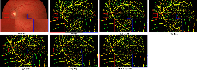 Figure 4 for SuperVessel: Segmenting High-resolution Vessel from Low-resolution Retinal Image