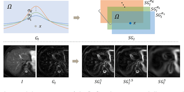 Figure 3 for Unsupervised MMRegNet based on Spatially Encoded Gradient Information