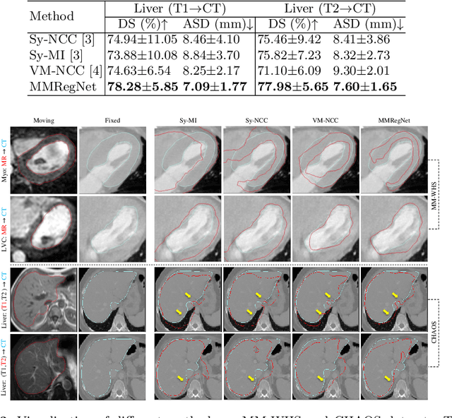 Figure 4 for Unsupervised MMRegNet based on Spatially Encoded Gradient Information