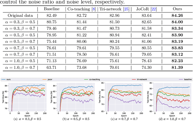 Figure 4 for Superpixel-guided Iterative Learning from Noisy Labels for Medical Image Segmentation