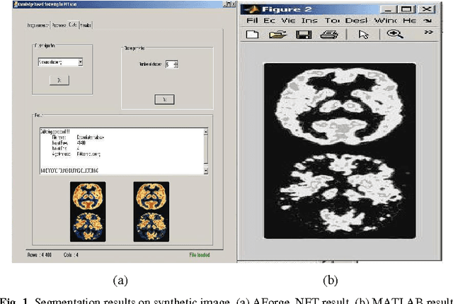 Figure 1 for K Means Segmentation of Alzheimers Disease in PET scan datasets: An implementation