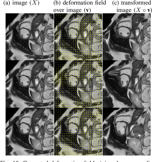 Figure 2 for Semi-supervised Task-driven Data Augmentation for Medical Image Segmentation