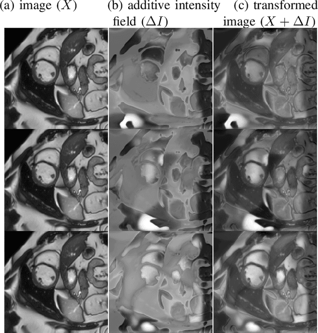 Figure 3 for Semi-supervised Task-driven Data Augmentation for Medical Image Segmentation