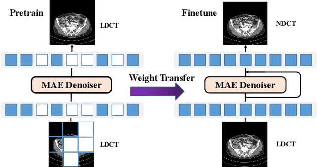 Figure 1 for Masked Autoencoders for Low dose CT denoising