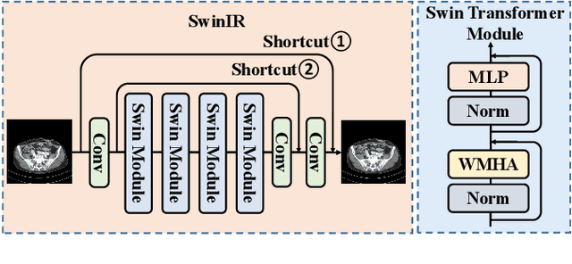Figure 3 for Masked Autoencoders for Low dose CT denoising