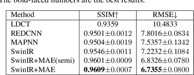 Figure 2 for Masked Autoencoders for Low dose CT denoising