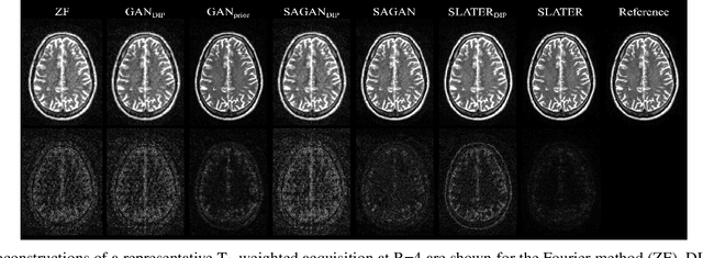 Figure 3 for Unsupervised MRI Reconstruction via Zero-Shot Learned Adversarial Transformers