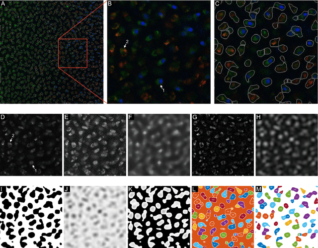 Figure 1 for A watershed-based algorithm to segment and classify cells in fluorescence microscopy images