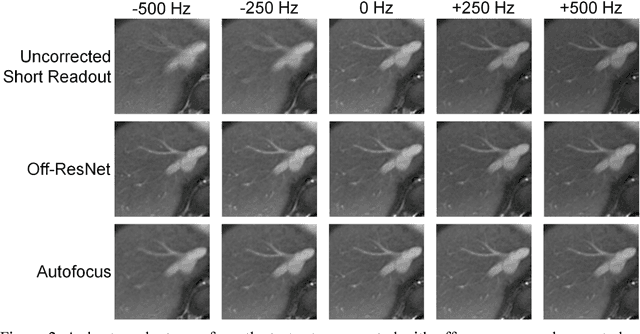 Figure 3 for Deep Residual Network for Off-Resonance Artifact Correction with Application to Pediatric Body Magnetic Resonance Angiography with 3D Cones