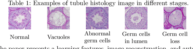 Figure 1 for A Novel Deep Learning Architecture for Testis Histology Image Classification