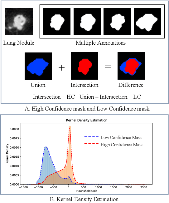 Figure 1 for Uncertainty-Aware Lung Nodule Segmentation with Multiple Annotations