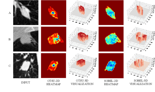 Figure 4 for Uncertainty-Aware Lung Nodule Segmentation with Multiple Annotations