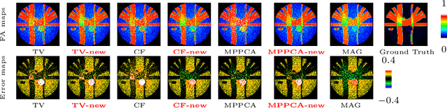 Figure 3 for Is Perfect Filtering Enough Leading to Perfect Phase Correction for dMRI data?