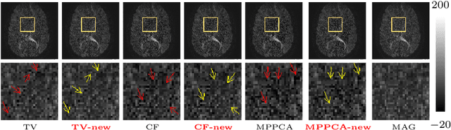 Figure 4 for Is Perfect Filtering Enough Leading to Perfect Phase Correction for dMRI data?
