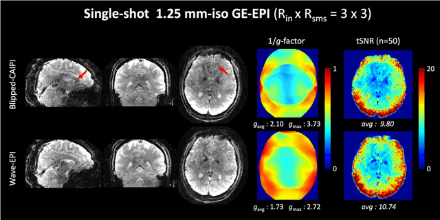 Figure 3 for Highly Accelerated EPI with Wave Encoding and Multi-shot Simultaneous Multi-Slice Imaging