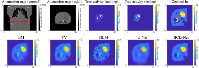 Figure 2 for Improved low-count quantitative PET reconstruction with a variational neural network