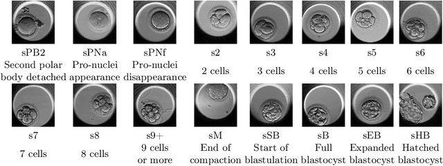 Figure 3 for Comparison of attention models and post-hoc explanation methods for embryo stage identification: a case study