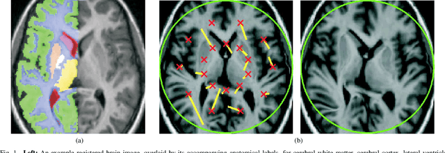 Figure 1 for Evaluating Registration Without Ground Truth